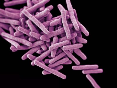 Mycobacterium tuberculosis. Imagen: Centro de Control y Prevención de Enfermedades. Instituto Nacional de Salud. EE.UU.