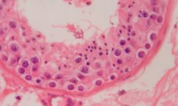 Corte histológico de un túbulo seminífero testicular humano que presenta una espermatogénesis conservada, donde se observan los diferentes estadíos madurativos de la línea germinal masculina. Imagen cortesía de Sara Larriba, IDIBELL.