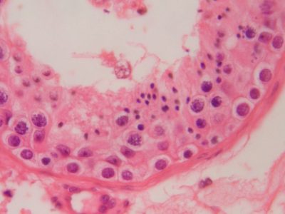 Corte histológico de un túbulo seminífero testicular humano que presenta una espermatogénesis conservada, donde se observan los diferentes estadíos madurativos de la línea germinal masculina. Imagen cortesía de Sara Larriba, IDIBELL.
