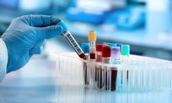 un análisis de sangre revela cambios tempranos en la enfermedad de Parkinson