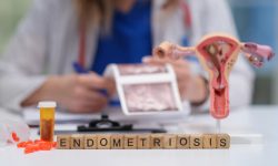 Un estudio con más de 1 millón de mujeres revela claves de la endometriosis