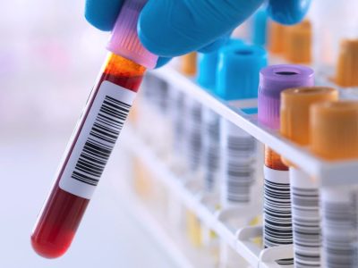 un reloj proteómico predice la edad biológica a partir de una muestra de sangre