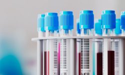 Una masterclass abordará potencial de biopsia líquida en detección precoz y diagnóstico de enfermedades.
