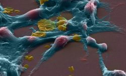 El cáncer es una enfermedad genética provocada por la presencia de mutaciones que llevan a que las células proliferen de forma descontrolada. Imagen: Células tumorales. Izzat Suffian, Pedro Costa, Stephen Pollard, David McCarthy & Khuloud T. Al-Jamal.